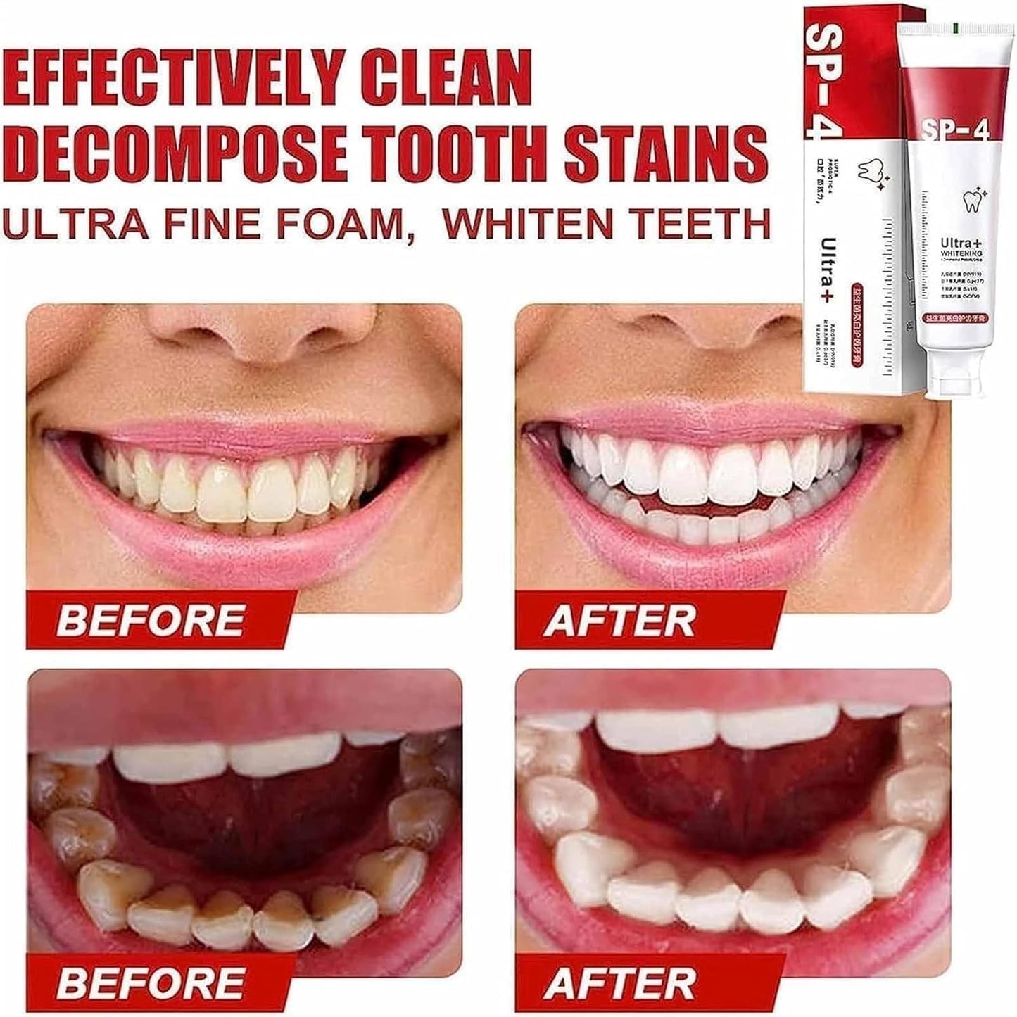 Yayashi Sp-4 Ultra Whitening Toothpaste Probiotic Stain Remover / Stain Removing Toothpaste, Protects Gums Freshens Breath, for Everyone
