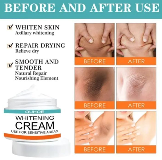 Pack Of 2 | Sensitive Area Whitening Cream for Private Parts, Underarms, Inner Thighs, and Dark Spot Lightening… - Image 4