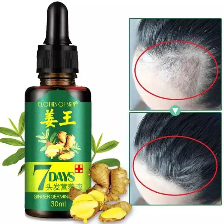 7 Days Hair Growth Germinal Serum Oil (30ML)
