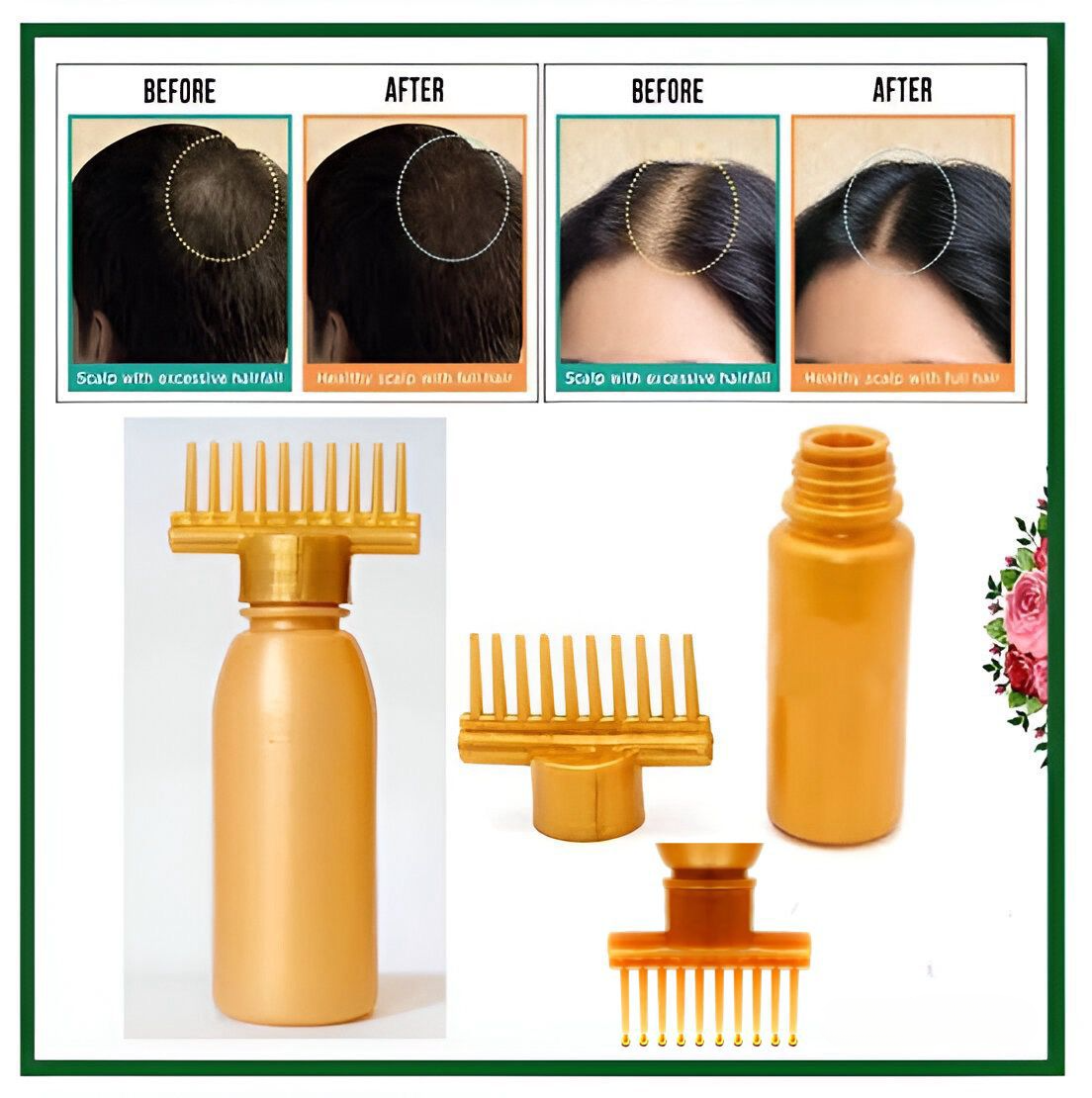 (Pack of 20) Hair dye bottle | Hair Oil Applicator Bottle, Root oiling Comb bottle for Hair Coloring, Shampoo… - Image 5